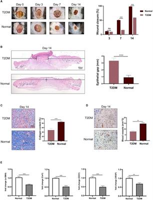 Improving depression-like behaviors caused by diabetes is likely to offer a new perspective for the treatment of non-healing chronic wounds